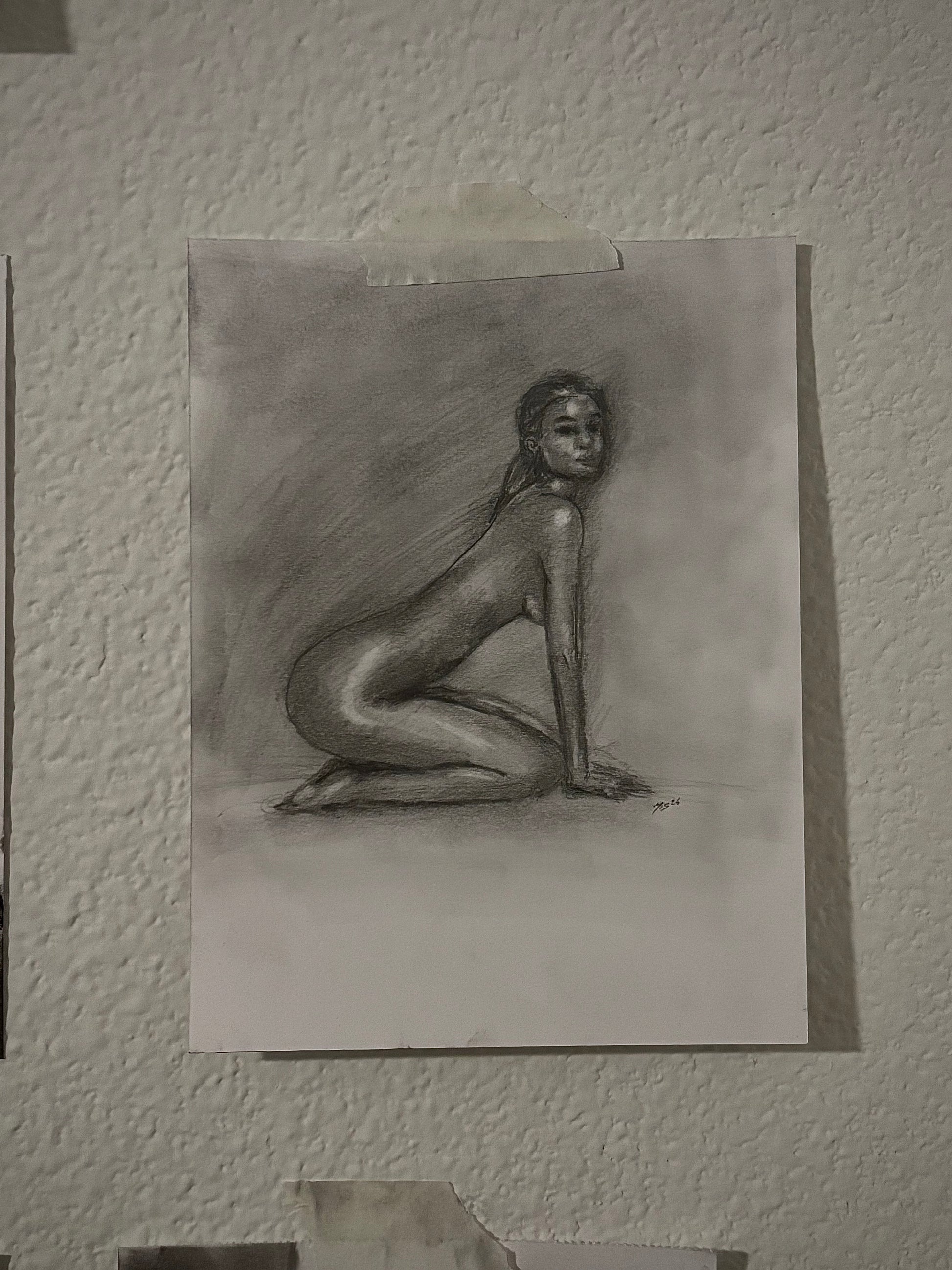 “Soft Tissue” (1 OF 1)