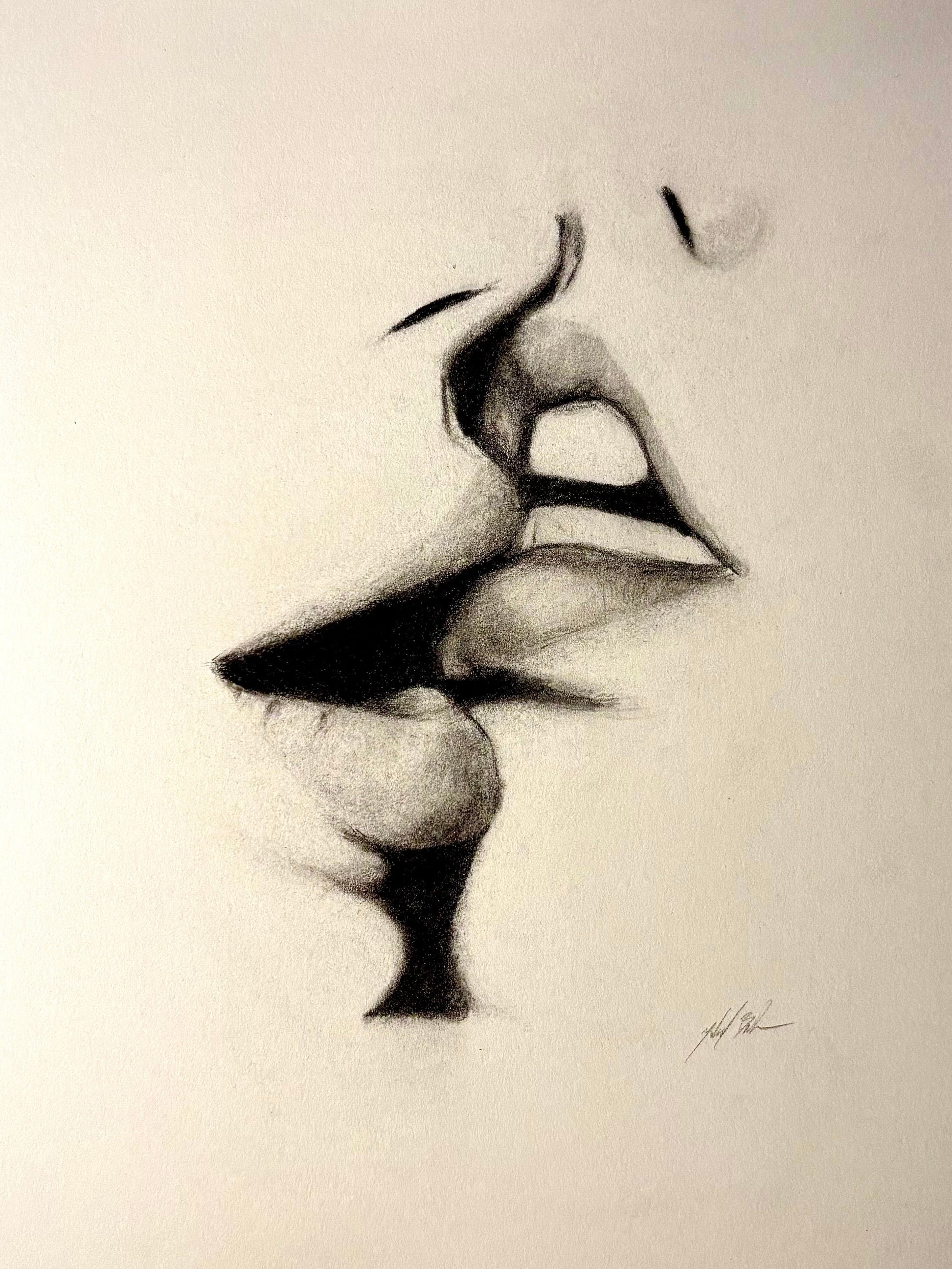 “Lip Filler”