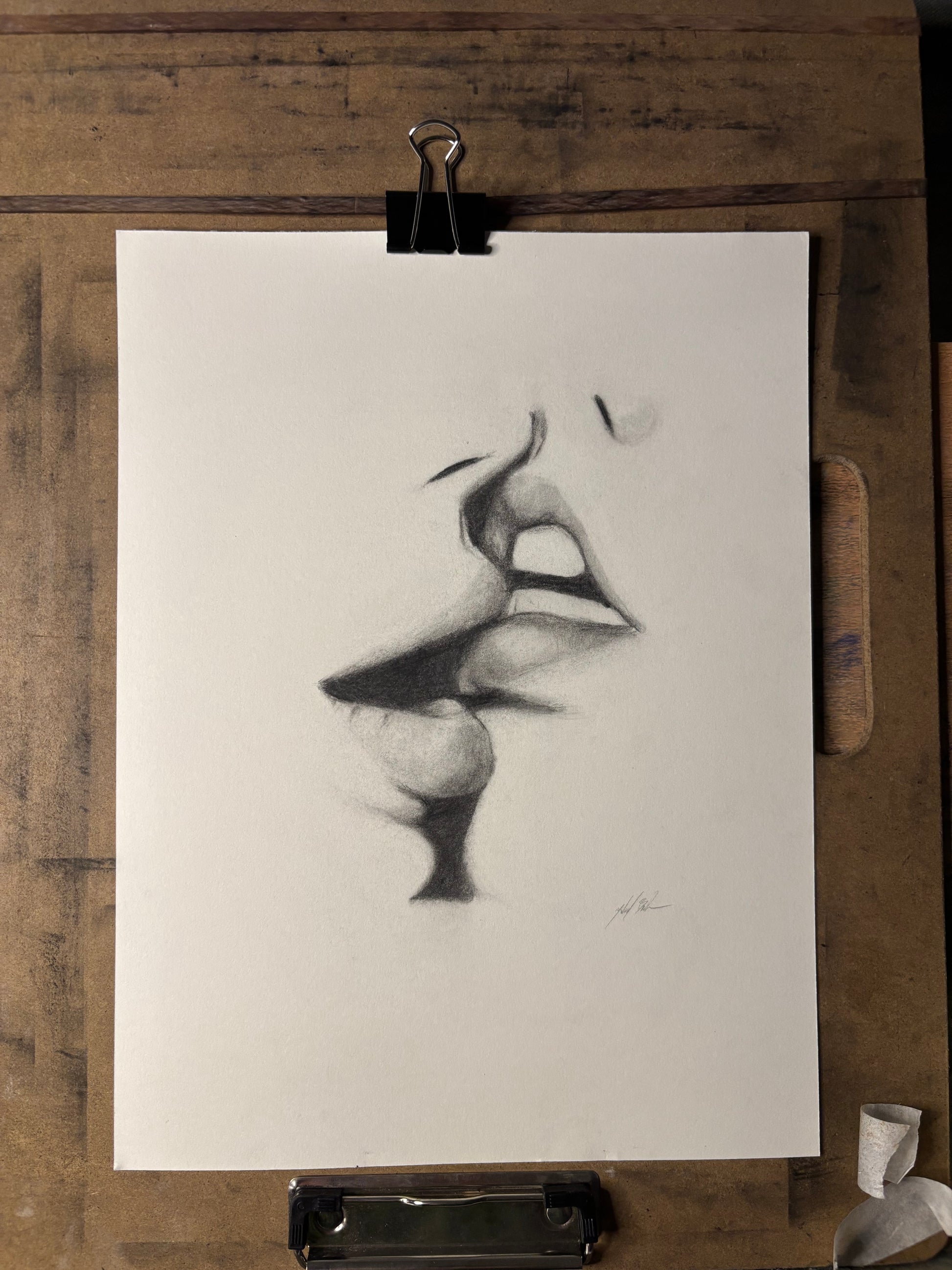 “Lip Filler”